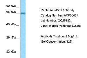 Western Blotting (WB) image for anti-Bridging Integrator 1 (BIN1) (Middle Region) antibody (ABIN2786209) (BIN1 抗体  (Middle Region))