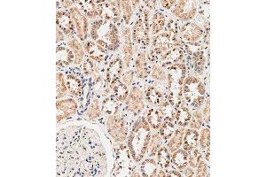 Immunohistochemical analysis of paraffin-embedded human kidney tissue using C performed on the Leica® BOND RXm. (NOX1 抗体  (AA 243-271))