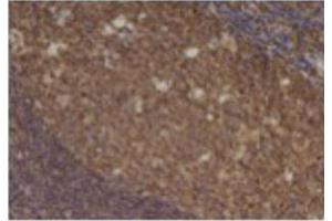 Image no. 3 for anti-Chemokine (C-C Motif) Ligand 5 (CCL5) antibody (ABIN465158) (CCL5 抗体)
