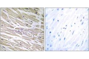 Immunohistochemistry analysis of paraffin-embedded human heart tissue, using LAMA4 Antibody. (LAMa4 抗体  (AA 481-530))