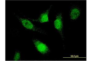Immunofluorescence of monoclonal antibody to SFRS12 on HeLa cell. (SFRS12 抗体  (AA 443-508))