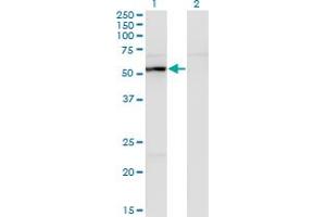 Western Blot analysis of UAP1 expression in transfected 293T cell line by UAP1 monoclonal antibody (M01), clone 3A9. (UAP1 抗体  (AA 406-504))