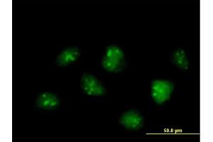 Immunofluorescence of  purified  MaxPab antibody to IFRD2 on HeLa cell. (IFRD2 抗体  (AA 1-442))