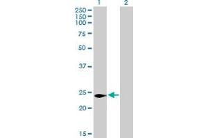 Western Blot analysis of C16orf5 expression in transfected 293T cell line by C16orf5 MaxPab polyclonal antibody. (CDIP1 抗体  (AA 1-208))