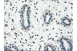 Immunohistochemical staining of paraffin-embedded breast tissue using anti-NRBP1 mouse monoclonal antibody. (NRBP1 抗体)