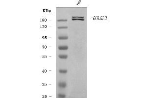 Western blot analysis of GOLGA3 using anti-GOLGA3 antibody (ABIN7600298).