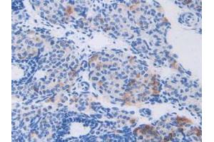 IHC-P analysis of Mouse Ovary Tissue, with DAB staining. (CAPNL1 抗体  (AA 387-694))