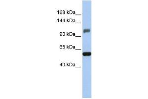 WB Suggested Anti-ZSCAN20 Antibody Titration:  0. (ZSCAN20 抗体  (Middle Region))