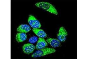 Confocal immunofluorescent analysis of WT1 antibody with MCF-7 cells followed by Alexa Fluor 488-conjugated goat anti-rabbit lgG (green). (WT1 抗体  (AA 346-375))