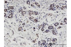 Immunoperoxidase of monoclonal antibody to CCDC115 on formalin-fixed paraffin-embedded human breast. (CCDC115 抗体  (AA 1-132))