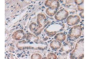 Immunohistochemistry (IHC) image for anti-Utrophin (UTRN) (AA 1-252) antibody (ABIN7443953)
