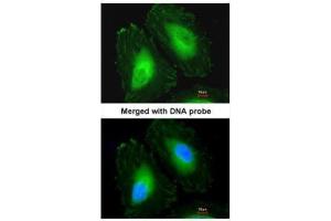ICC/IF Image Immunofluorescence analysis of paraformaldehyde-fixed HeLa, using Beta-crystallin A4, antibody at 1:200 dilution. (CRYbA4 抗体)