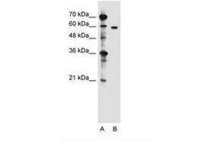 Image no. 2 for anti-Zinc Finger, DHHC-Type Containing 13 (ZDHHC13) (N-Term) antibody (ABIN205045) (ZDHHC13 抗体  (N-Term))