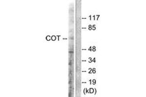 Western Blotting (WB) image for anti-Mitogen-Activated Protein Kinase Kinase Kinase 8 (MAP3K8) (AA 256-305) antibody (ABIN2888594) (MAP3K8 抗体  (AA 256-305))
