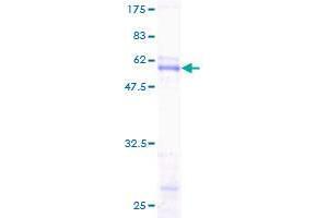 Image no. 1 for Sodium Channel Modifier 1 (SCNM1) (AA 1-230) protein (GST tag) (ABIN1319287)