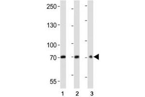 Western blot analysis of lysate from (1) U266, (2) HepG2 cell line, (3) mouse brain tissue lysate using CD73 antibody at 1:2000. (CD73 抗体  (AA 520-550))