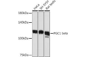 Western blot analysis of extracts of various cell lines, using PGC1 beta Rabbit mAb (ABIN1680494, ABIN3018825, ABIN3018826 and ABIN7101668) at 1:1000 dilution. (PPARGC1B 抗体)
