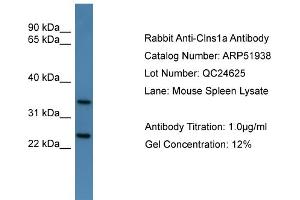 WB Suggested Anti-Clns1a  Antibody Titration: 0. (CLNS1A 抗体  (C-Term))