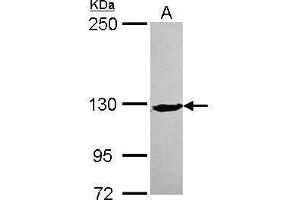 XPC 抗体  (C-Term)