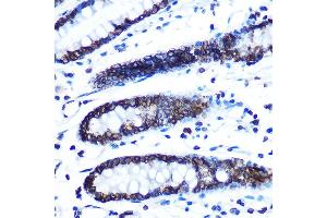 Immunohistochemistry of paraffin-embedded human colon using Lamin B1 Rabbit mAb (ABIN7268180) at dilution of 1:100 (40x lens). (Lamin B1 抗体)