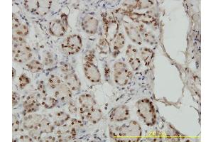 Immunostaining (ISt) image for anti-SMAD, Mothers Against DPP Homolog 1 (SMAD1) (AA 1-110) antibody (ABIN561713)