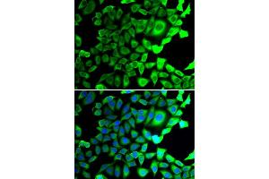 Immunofluorescence analysis of A549 cell using USP8 antibody. (USP8 抗体)