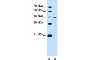 Western Blotting (WB) image for anti-Ring Finger Protein 25 (RNF25) antibody (ABIN2462680) (RNF25 抗体)