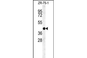 PSG9 Antibody (Center) (ABIN654403 and ABIN2844144) western blot analysis in ZR-75-1 cell line lysates (35 μg/lane). (PSG9 抗体  (AA 108-137))