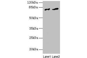 Western blot All lanes: FAM161A antibody at 8 μg/mL Lane 1: Human placenta tissue Lane 2: Mouse liver tissue Secondary Goat polyclonal to rabbit IgG at 1/10000 dilution Predicted band size: 77, 65, 84 kDa Observed band size: 77 kDa (FAM161A 抗体  (AA 1-300))