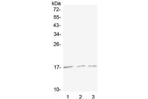 Western blot testing of 1) mouse spleen, 2) mouse kidney and 3) rat kidney lysate with Lymphotactin antibody at 0. (XCL1 抗体)