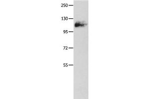 Western Blot analysis of Mouse lung tissue using Amphiphysin I Polyclonal Antibody at dilution of 1:500 (Amphiphysin 抗体)