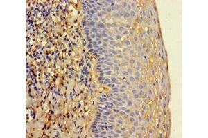 Immunohistochemistry of paraffin-embedded human tonsil tissue using ABIN7142130 at dilution of 1:100 (RNASEL 抗体  (AA 330-741))