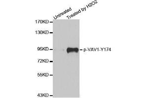 Western blot analysis of extracts from Jurkat cells,using phospho-VAV1-Y174 antibody (ABIN2987533). (VAV1 抗体  (pTyr174))