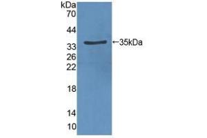 Detection of Recombinant VEGFR2, Rat using Polyclonal Antibody to Vascular Endothelial Growth Factor Receptor 2 (VEGFR2) (VEGFR2/CD309 抗体  (AA 46-320))