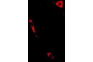 Immunofluorescent analysis of PTGES2 staining in A549 cells.