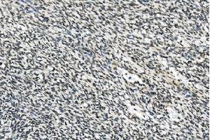 IHC analysis of HOXD11 using anti-HOXD11 antibody (ABIN7603174). (HOXD11 抗体  (N-Term))