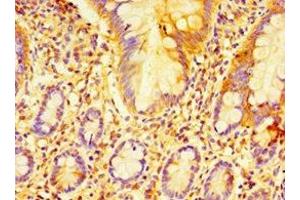 Immunohistochemistry of paraffin-embedded human small intestine tissue using ABIN7152225 at dilution of 1:100 (ECSIT 抗体  (AA 185-431))