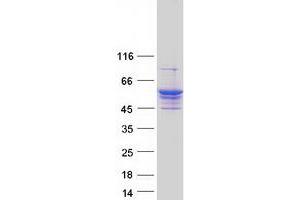 Validation with Western Blot