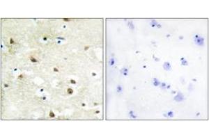 Immunohistochemistry analysis of paraffin-embedded human brain tissue, using hnRNP C1/C2 Antibody. (HNRNPC 抗体  (AA 241-290))