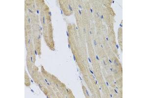 Immunohistochemistry of paraffin-embedded mouse heart using PRPH antibody at dilution of 1:100 (x40 lens). (Peripherin 抗体)