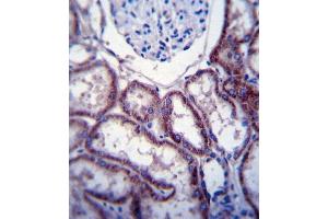 FER Antibody (C-term) (ABIN392094 and ABIN2841847) immunohistochemistry analysis in formalin fixed and paraffin embedded human kidney tissue followed by peroxidase conjugation of the secondary antibody and DAB staining. (FER 抗体  (C-Term))