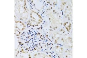 Immunohistochemistry of paraffin-embedded human kidney using MAPK3 Antibody. (ERK1 抗体)