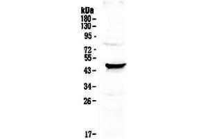Western blot analysis of NOV/CCN3 using anti-NOV/CCN3 antibody . (NOV 抗体  (C-Term))
