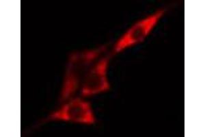 ABIN6267518 staining HeLa cells by IF/ICC. (MTOR 抗体  (pSer2481))