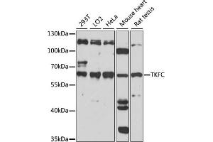 Western blot analysis of extracts of various cell lines, using TKFC antibody (ABIN7266775). (DAK 抗体  (AA 226-575))