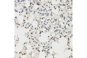 Immunohistochemistry of paraffin-embedded mouse lung using KDM4A antibody (ABIN5975678) at dilution of 1/100 (40x lens). (KDM4A 抗体)