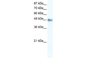 WB Suggested Anti-MAP3K8 Antibody Titration: 2. (MAP3K8 抗体  (C-Term))