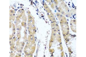 Immunohistochemistry of paraffin-embedded Human stomach using COL9A1 Polyclonal Antibody at dilution of 1:100 (40x lens). (COL9A1 抗体)