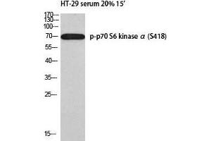 Western Blot (WB) analysis of HT-29 serum 20% 15' using p-p70 S6 kinase alpha (S418) antibody.