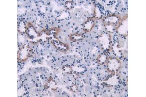 Used in DAB staining on fromalin fixed paraffin- embedded kidney tissue (PIM1 抗体  (AA 38-177))